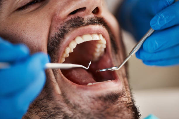 Best After-Hours Dental Trauma Care in Morganville, NJ
